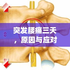 突发腰痛三天,原因与应对方法探讨