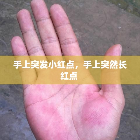 手上突发小红点，手上突然长红点