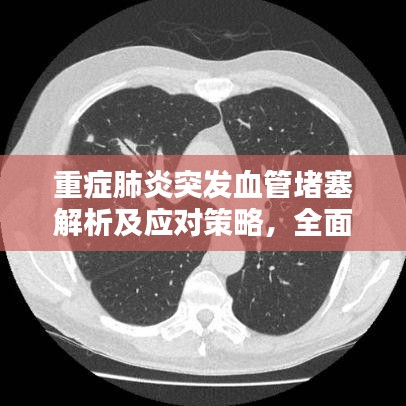 重症肺炎突发血管堵塞解析及应对策略，全面探讨与应对建议